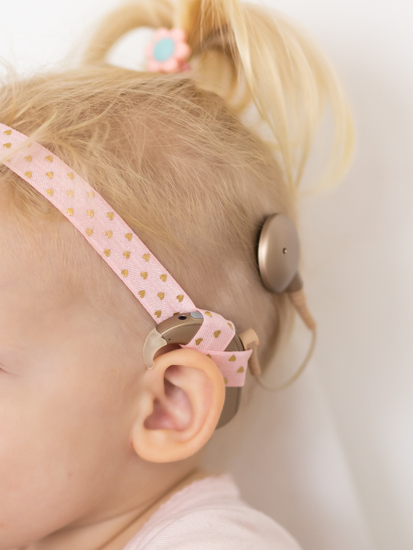A child wearing a cochlear implant behind the ear — the external sound processor and the magnetic disc that connects to the surgically implanted internal device. The product built from what was done inside the cat’s skull.