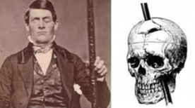 A historical photo of a man holding a rod next to an illustration of a skull with a rod piercing it, likely depicting Phineas Gage's famous injury.