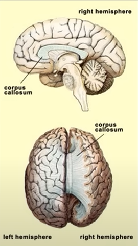 Illustration of a human brain with labeled parts: right hemisphere, left hemisphere, and corpus callosum, shown in sagittal and coronal views.