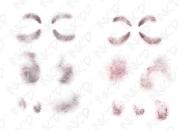 Facial Bruises - Stage 1 & Stage 2