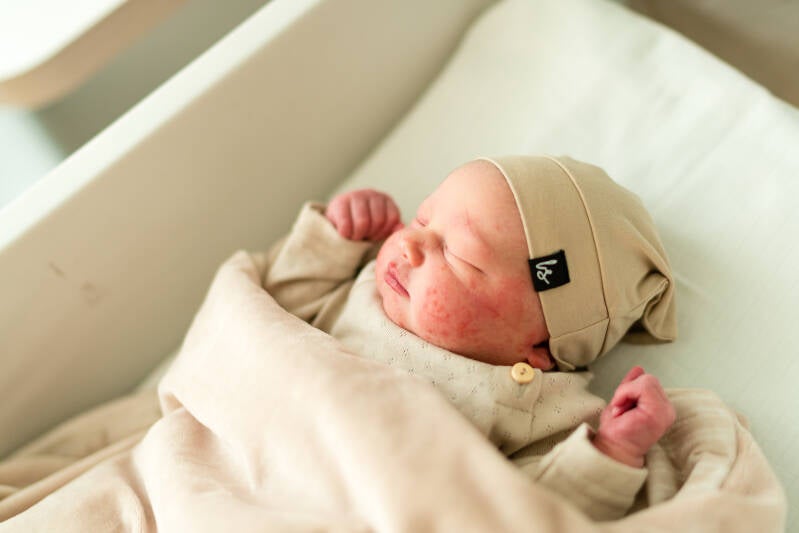 fresh48 fotoshoot in Uz gasthuisberg