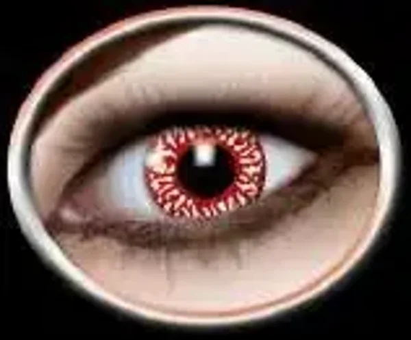 Blood shot