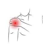 Schulterschmerzen, Schulterverletzung