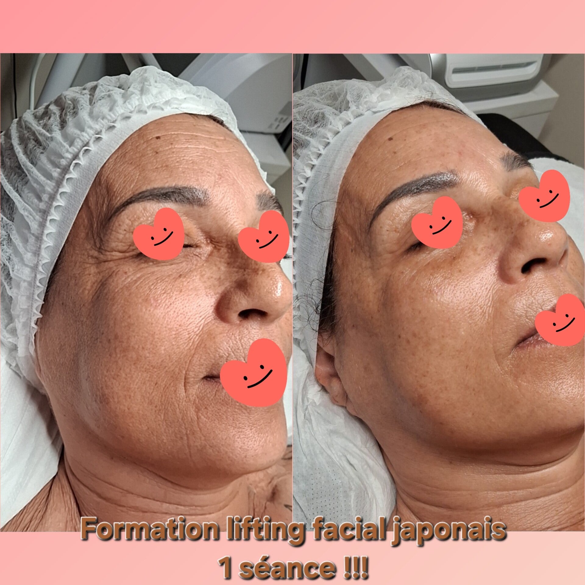 Formation lifting facial japonais