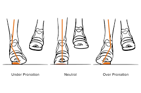 gait-analysis-standard.png