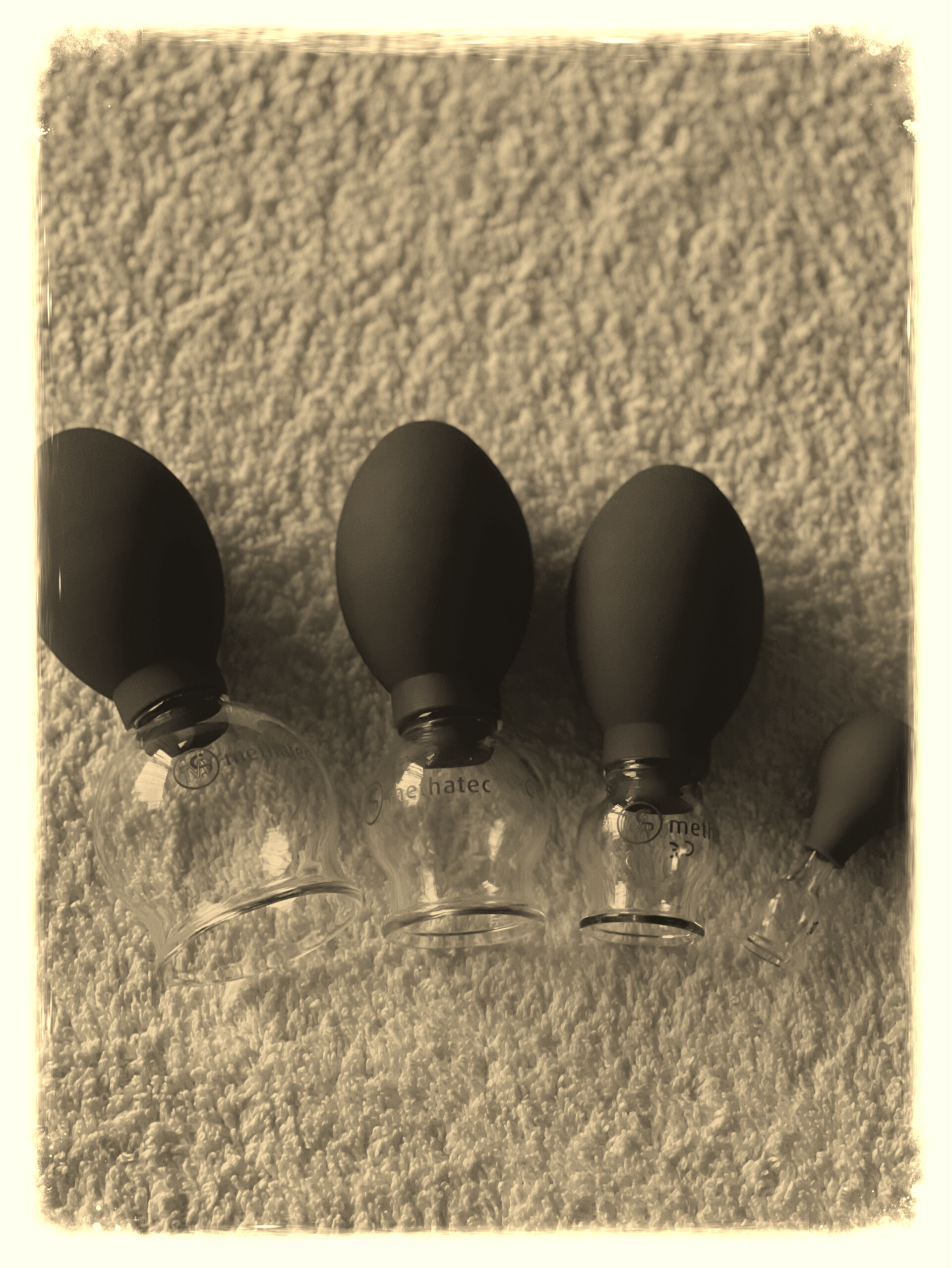 Cupping
