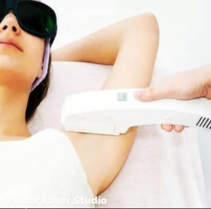 Laser hair removal treatment