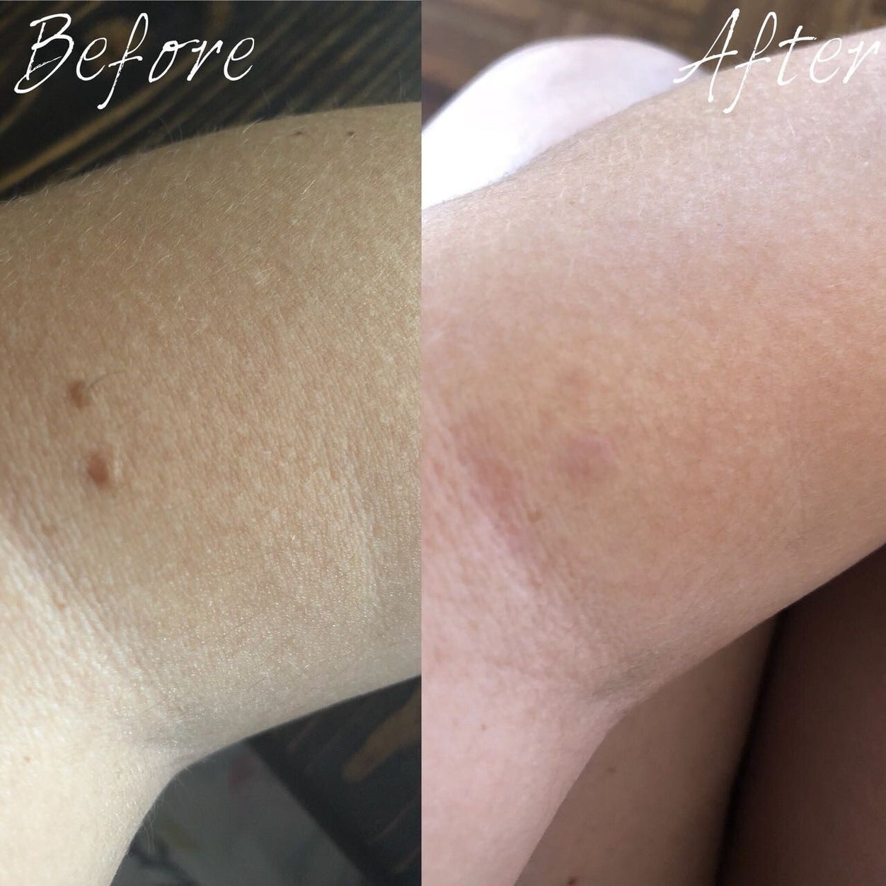 Mole Removal Chorley before and after