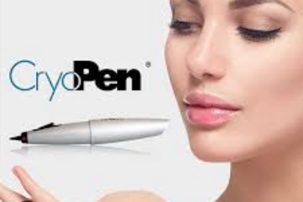 Skin tag removal