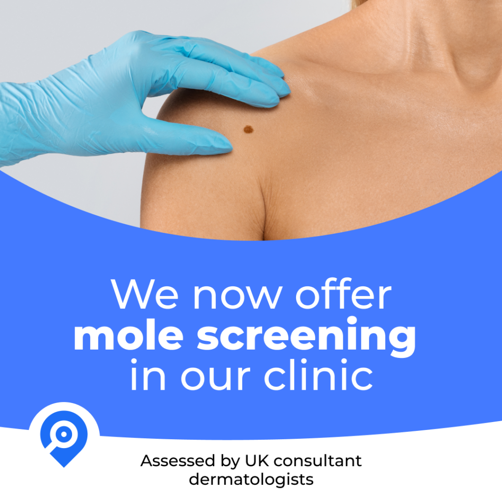 Map My Mole digital mole mapping at Pulsar Laser Studio