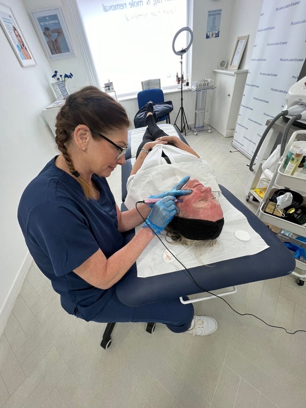 IPL skin rejuvenation