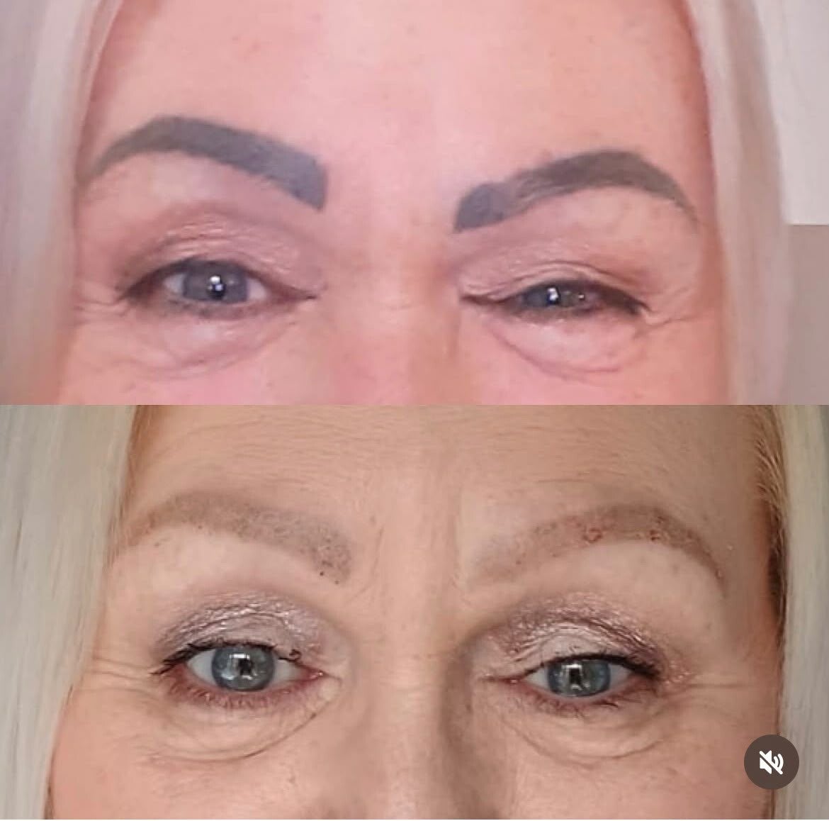 Two photographs showing eyebrow tattoo pigment at different appearances