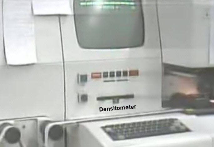 MSP densitometer
