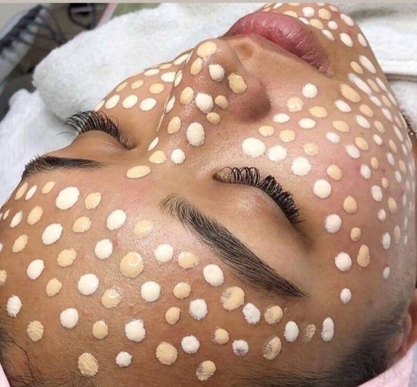BB GLOW & MICRO-NEEDLING