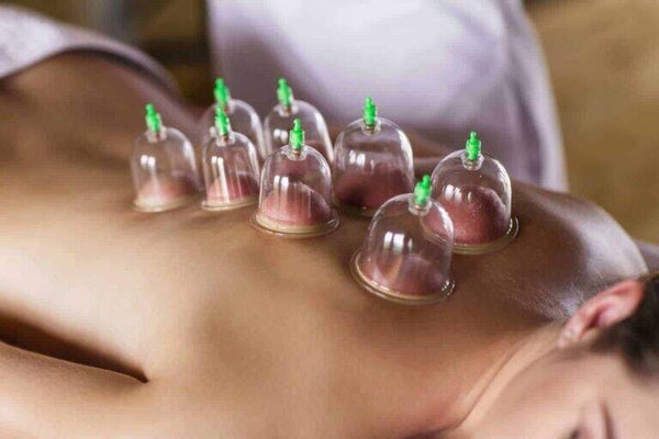 Cupping therapie