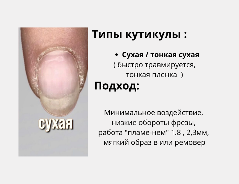zip-1-standard-edwfl0.png