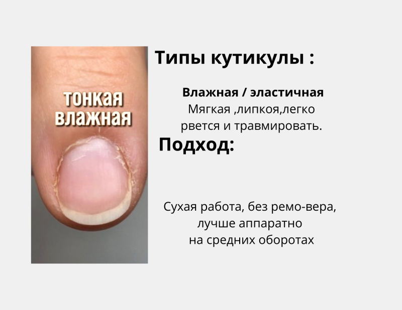 zip-3-standard-5f612f.png