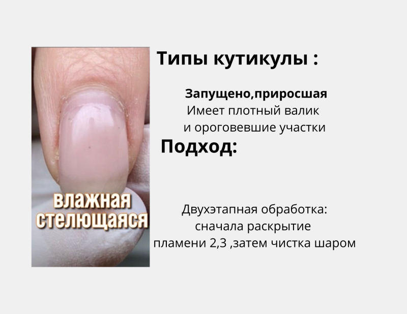 zip-4-standard-v438eh.png