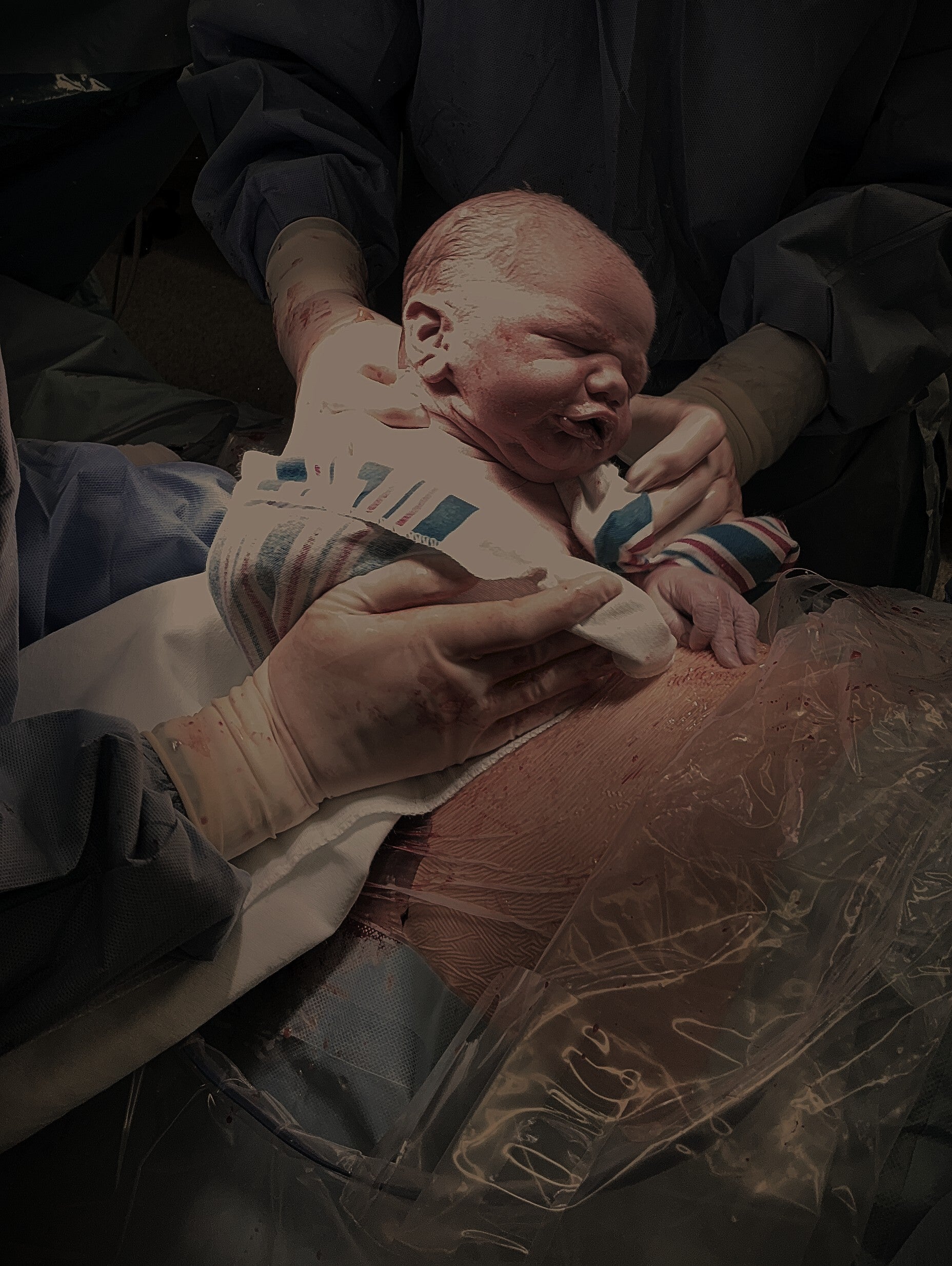keizersnede, doula support, buikgeboorte, verloskwartier, geboren via keizersnede, bevalling, angst voor de bevalling, mechelen, zemst, steun bij keizersnede