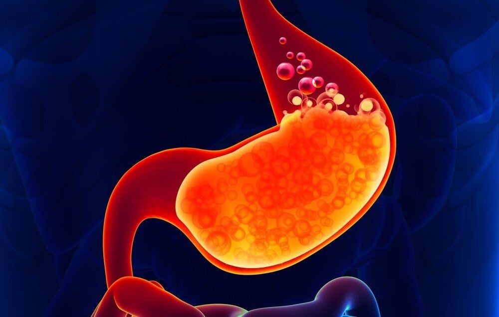 Indigestion Treatment
