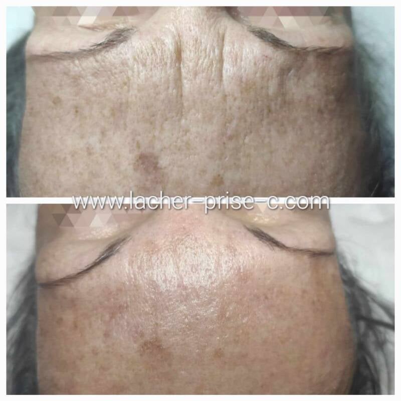 lacher-prise Calais 62100, soin visage anti-âge et massage