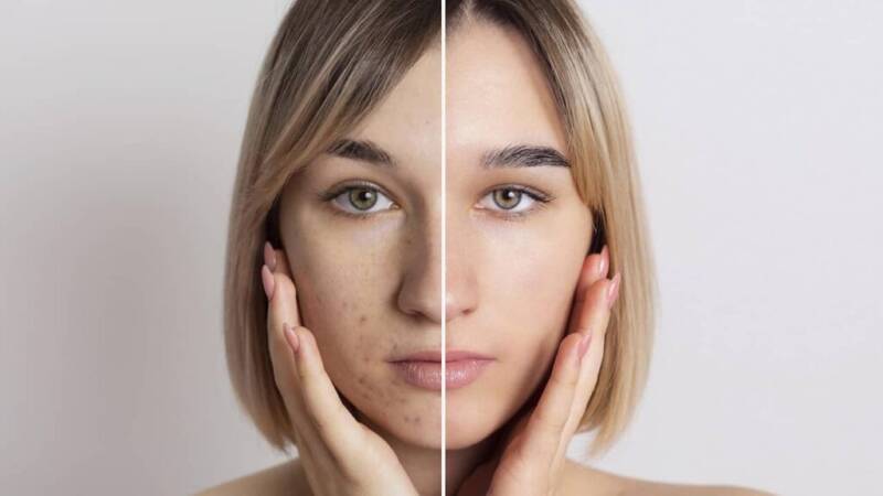 lacher-prise Calais 62100, soin visage anti-âge et massage