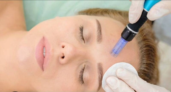Microneedling 1 session