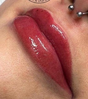 lips1-standard.jpg