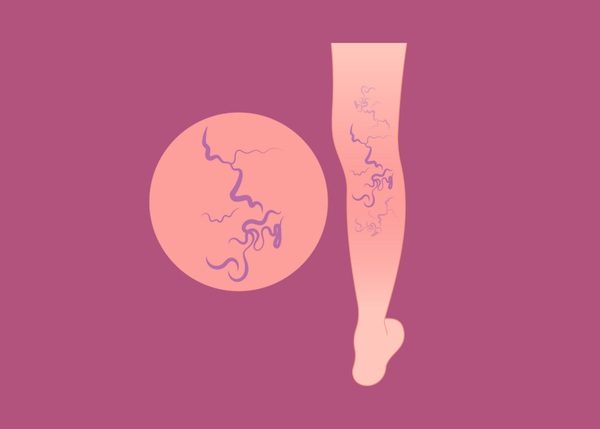 Vascular Pathophysiology