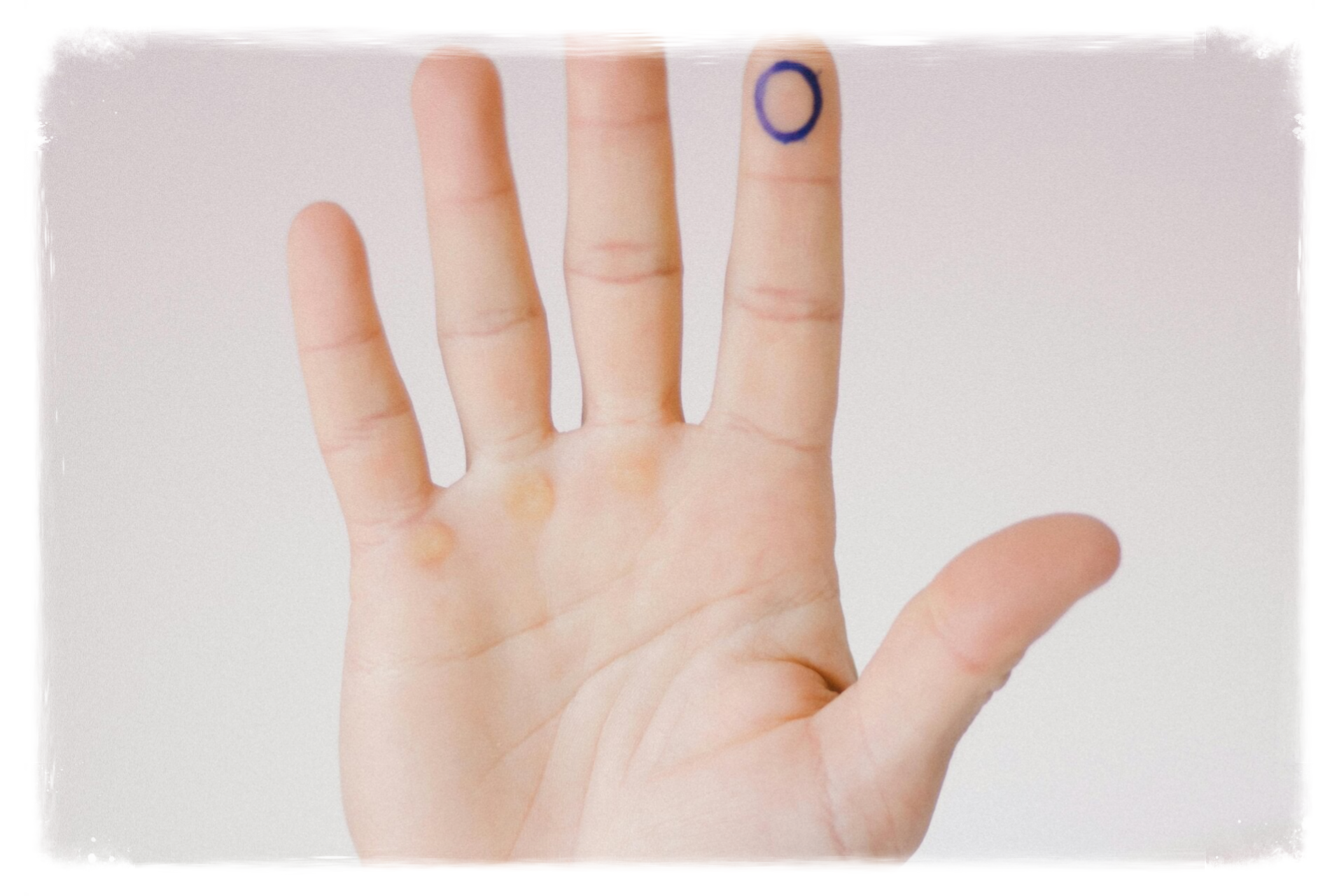 Hypnose Hypnothérapie hypnothérapeute