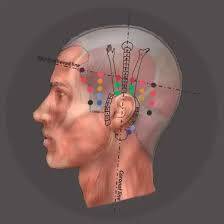Cranioponcture - Marc Ruiz 