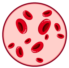 Drépanocytose Ossoma-Lesmois