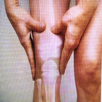 knee-standard-k4qv92.jpg