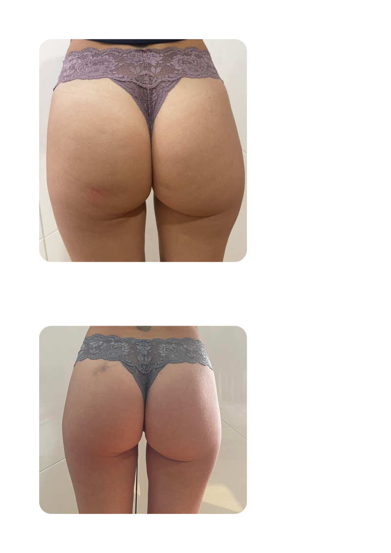 comparison-16-treatments-standard-1leieb.png