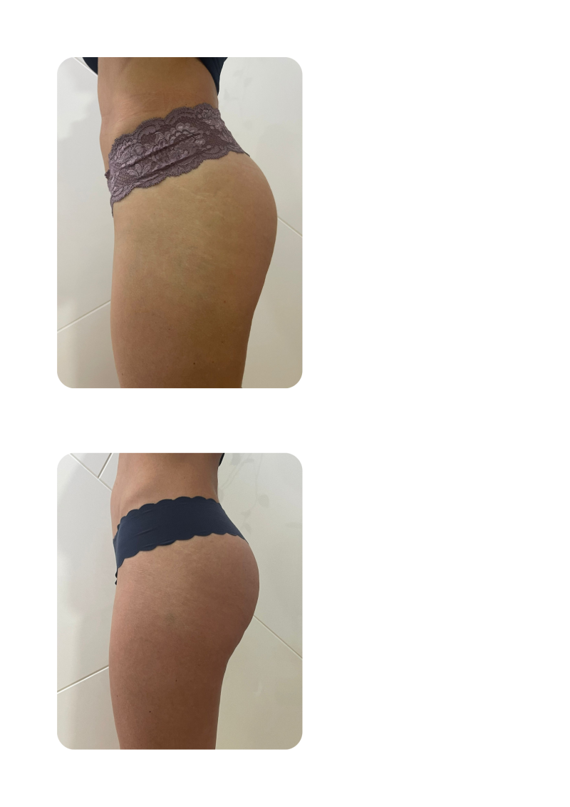 comparison-16-treatments1-standard-bzbrtu.png