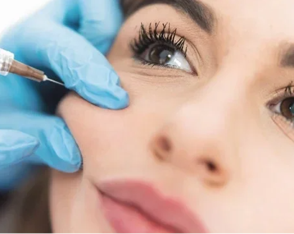 RELLENO DE ÁCIDO HIALURÓNICO