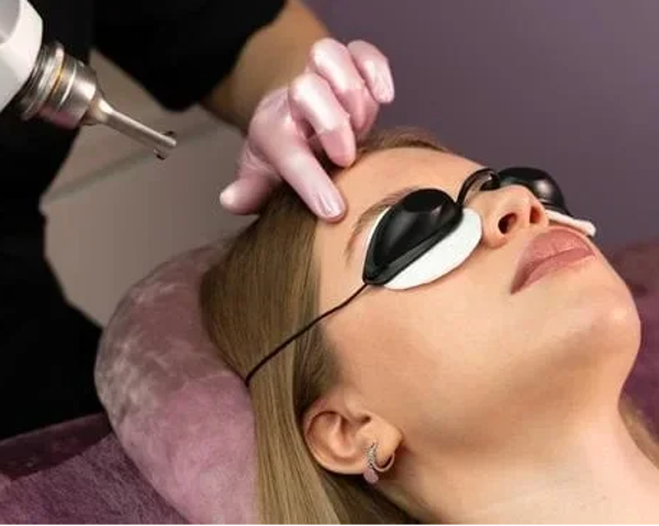 LASER Q-SWITCHED (MANCHAS) desde