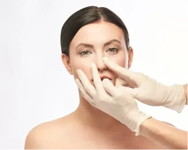 RINOPLASTIA ULTRASÓNICA