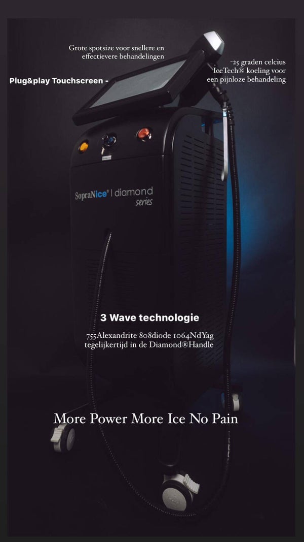 Laserontharing SopraNice Diamond Series