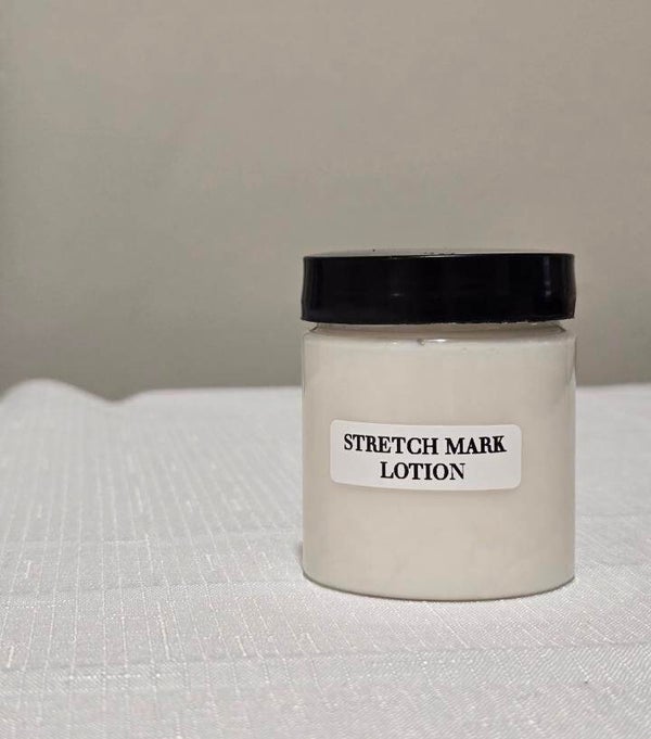Stretch Mark Lotion