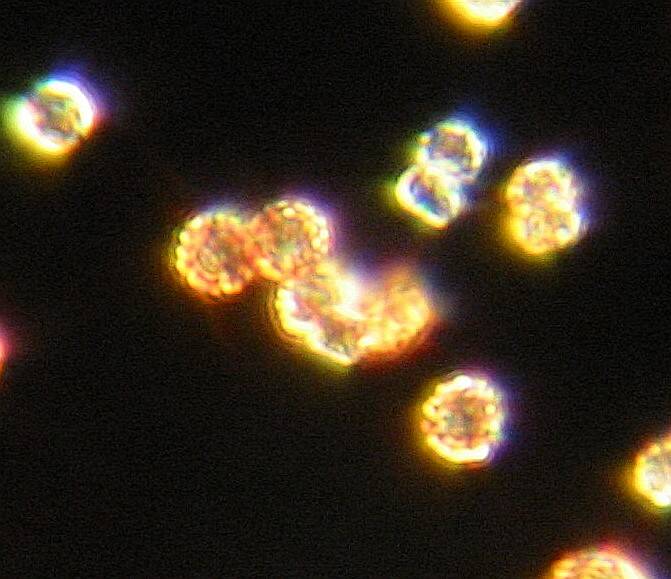 Mold Spores