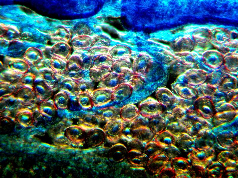 Tapeworm in Blood Cells
