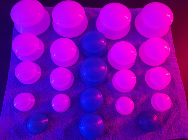 Dry Cupping Therapy