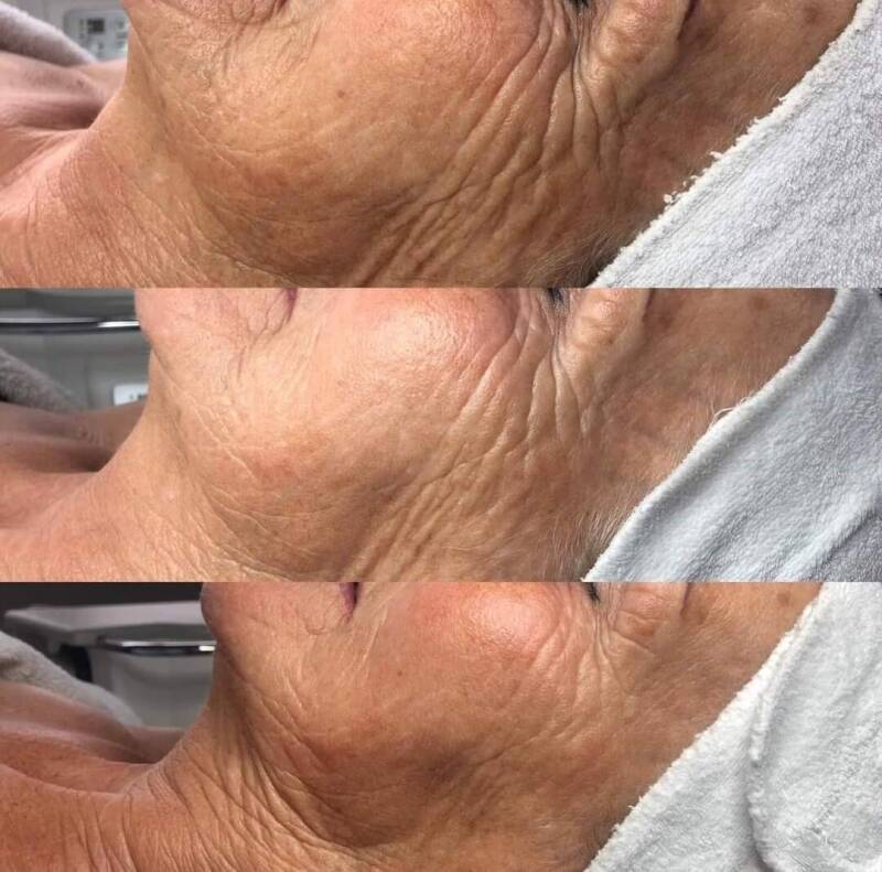 Resultaten Bio Pulse-Eindhoven