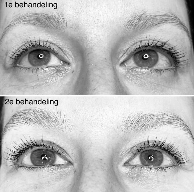 Lashlift versus lashfiller
