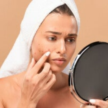 BOHR Effekt, Aknebehandlung, Peeling, Oxygen Oxypods, Sauerstoffbehandlung, stRichpunkt Mäder, Gesichtsbehandlung