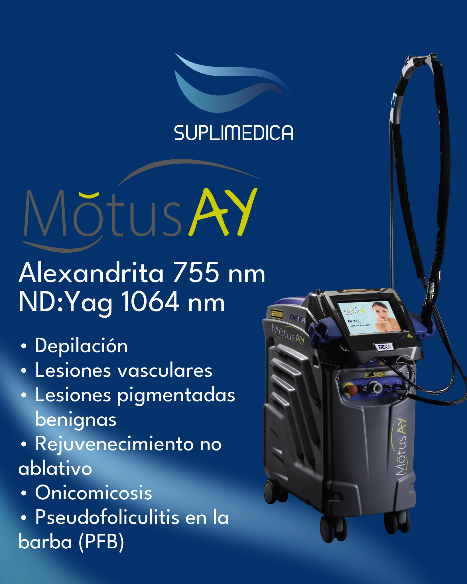 Motus AY de DEKA