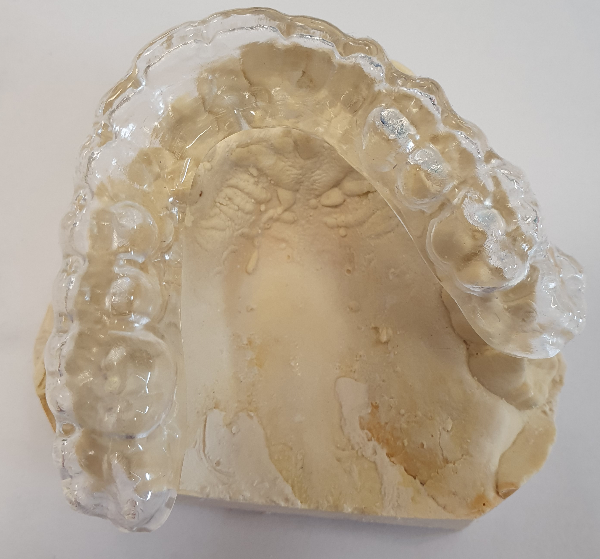 Bite Splint Pick up