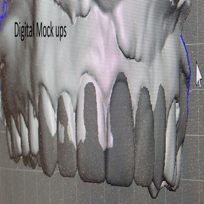 digital5.png