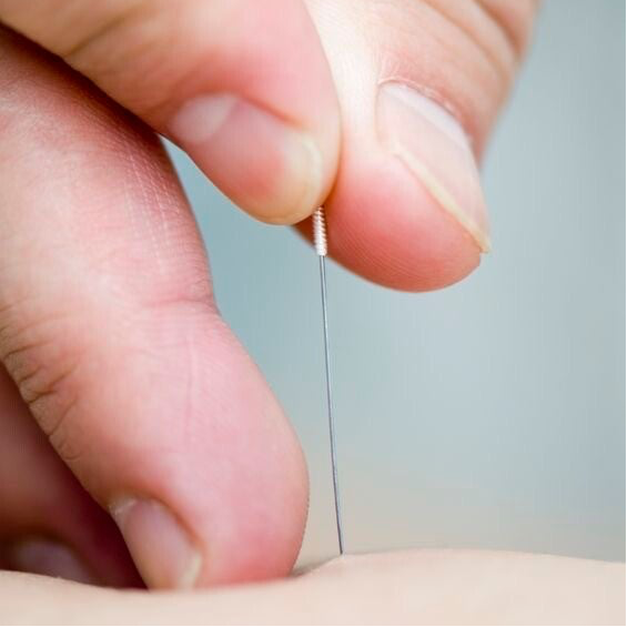 Dry Needling - Kianu Van der Keilen - Waarloos